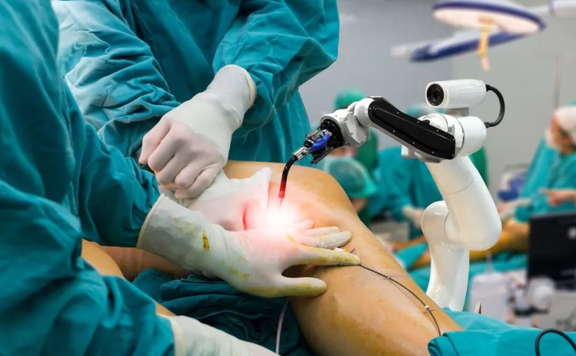 robotic knee replacement surgery