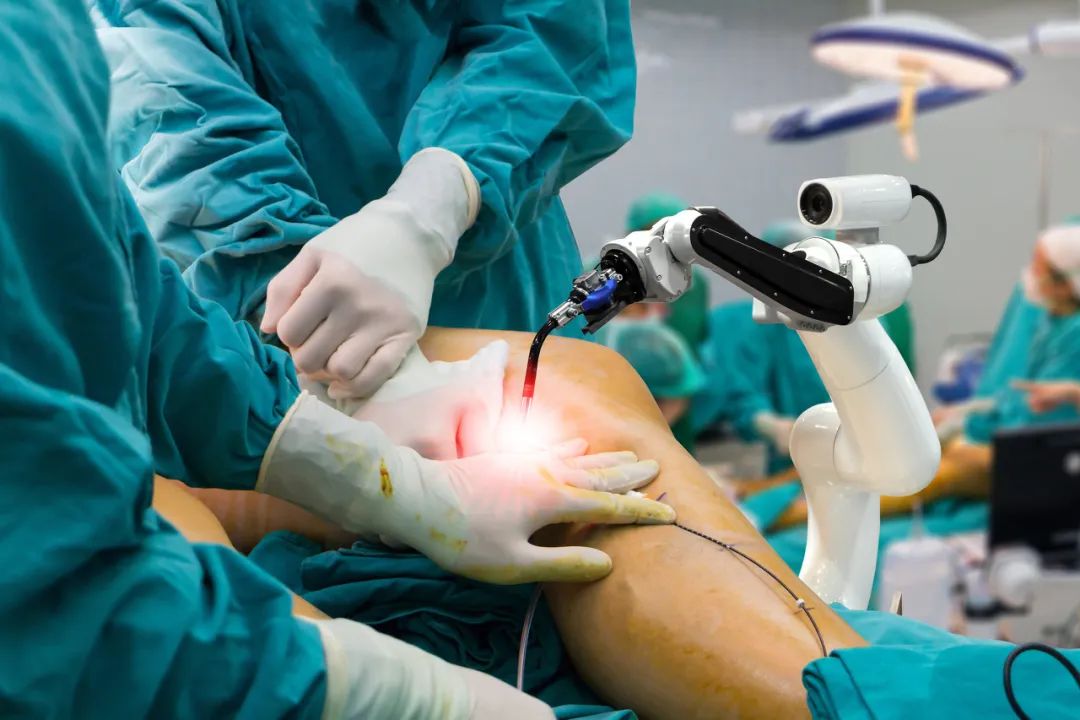 robotic knee replacement surgery